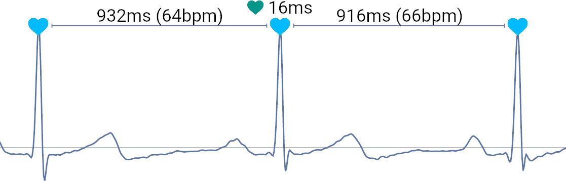 Herzratenvariabilität